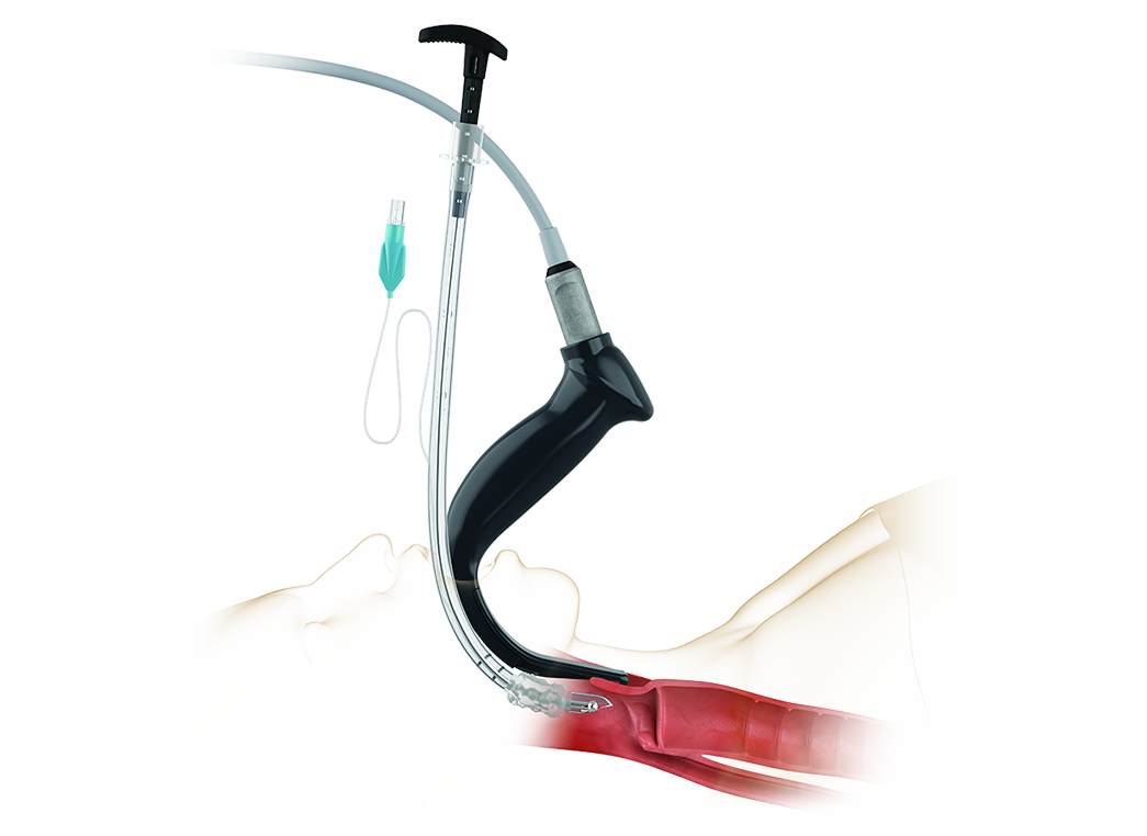 Video Laryngoscopes GlideScope Verathon