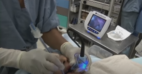 GlideScope Pediatric Airway Rounds Case Study: 4-year-old, Goldenhar Syndrome