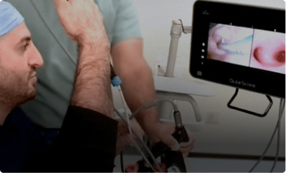 Video Laryngoscopy Assisted Bronchoscopic Intubation