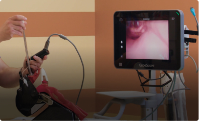 Video Laryngoscopy with a Mac-Style Blade Demonstrated by Dr. Rich Levitan, M.D.