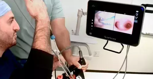 Video Laryngoscopy Assisted Bronchoscopic Intubation with GlideScope® Core™ 15