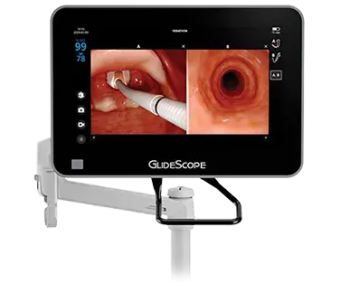 GlideScope Core monitor