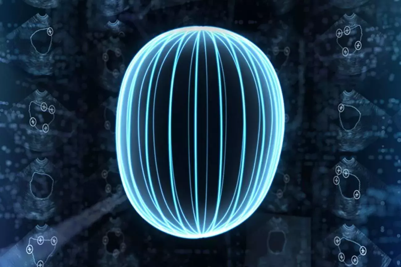 Artificial Intelligence in Bladder Volume Measurement