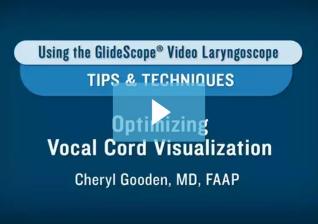 tips-optimizing-vocal-cord